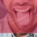 Condoms and Dental Dams for Genital Contact