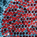 Reducing Transmission of HSV-1 and HSV-2: Prevention Measures