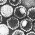 Understanding the Routes of Transmission for HSV-1 and HSV-2