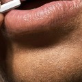 Valacyclovir: An Overview of Treatments and Solutions