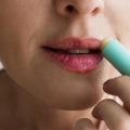 Topical Creams for Preventing Outbreaks