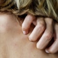 Understanding and Treating Itchiness with Anti-Itch Medications