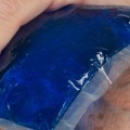 Cool Compresses: A Natural Remedy for Itching