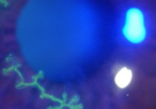 A Comprehensive Overview of Immune System Suppression and Herpes