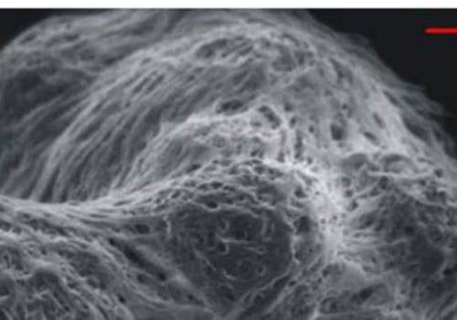 Understanding Transmission of Varicella Zoster Virus (VZV)