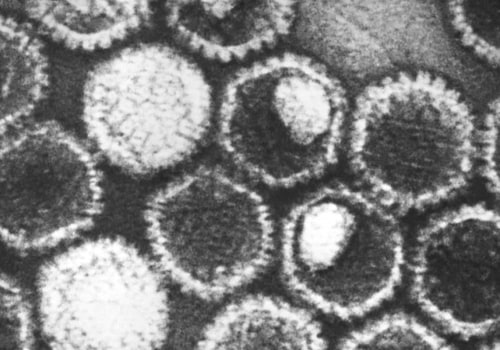 Understanding the Routes of Transmission for HSV-1 and HSV-2