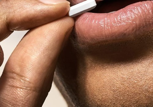Valacyclovir: An Overview of Treatments and Solutions